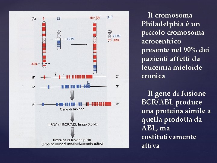 Il cromosoma Philadelphia è un piccolo cromosoma acrocentrico presente nel 90% dei pazienti affetti