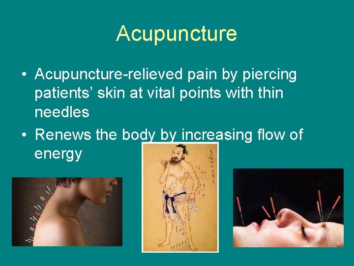 Acupuncture • Acupuncture-relieved pain by piercing patients’ skin at vital points with thin needles