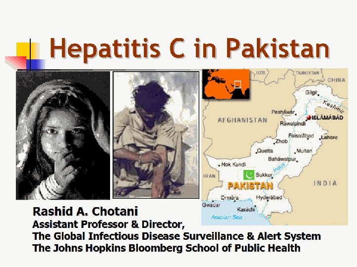 Hepatitis C in Pakistan Rashid A. Chotani Assistant Professor & Director, The Global Infectious