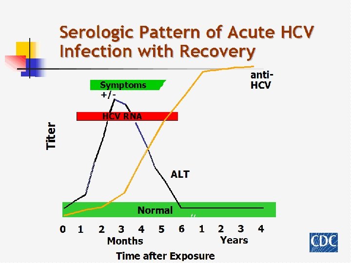 Serologic Pattern of Acute HCV Infection with Recovery anti. HCV Symptoms +/- Titer HCV