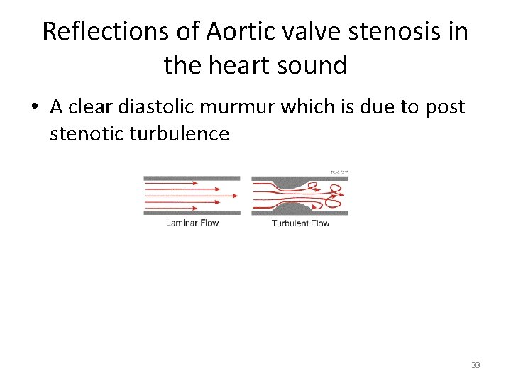 Reflections of Aortic valve stenosis in the heart sound • A clear diastolic murmur