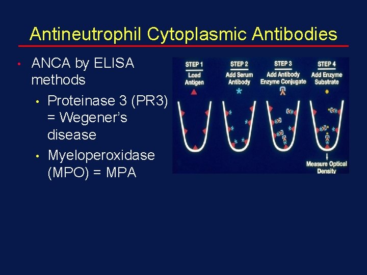 Antineutrophil Cytoplasmic Antibodies • ANCA by ELISA methods • Proteinase 3 (PR 3) =