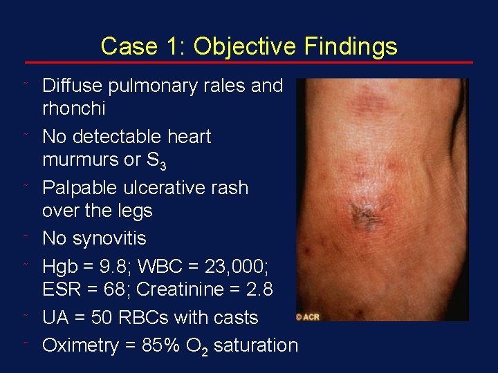 Case 1: Objective Findings ˜ ˜ ˜ ˜ Diffuse pulmonary rales and rhonchi No