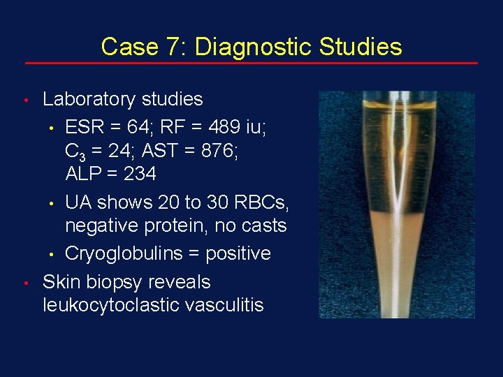 Case 7: Diagnostic Studies • • Laboratory studies • ESR = 64; RF =