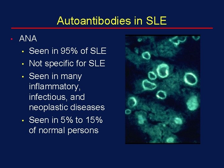 Autoantibodies in SLE • ANA • Seen in 95% of SLE • Not specific