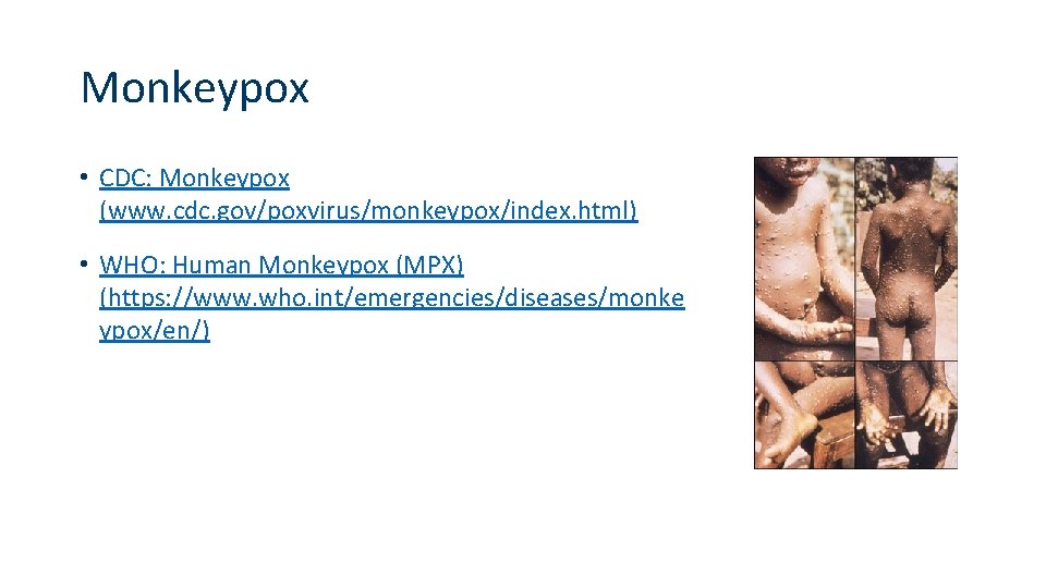 Monkeypox • CDC: Monkeypox (www. cdc. gov/poxvirus/monkeypox/index. html) • WHO: Human Monkeypox (MPX) (https: