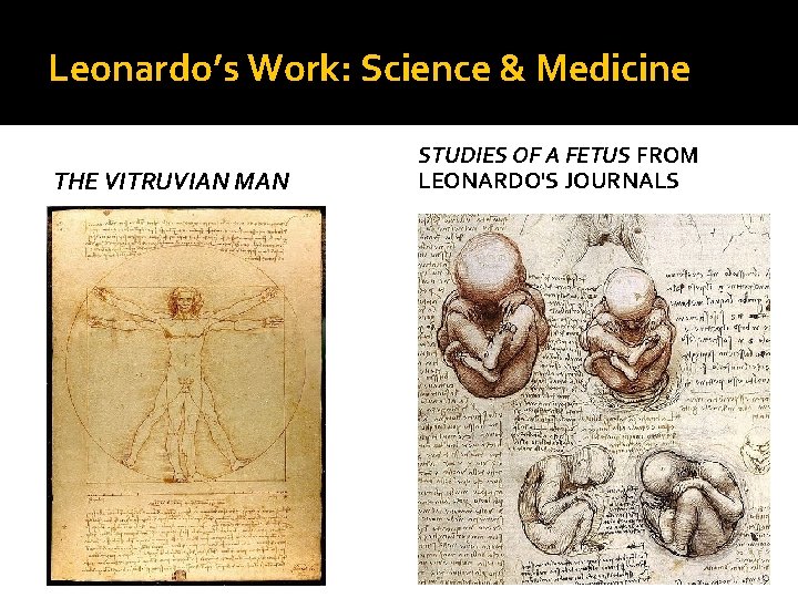 Leonardo’s Work: Science & Medicine THE VITRUVIAN MAN STUDIES OF A FETUS FROM LEONARDO'S