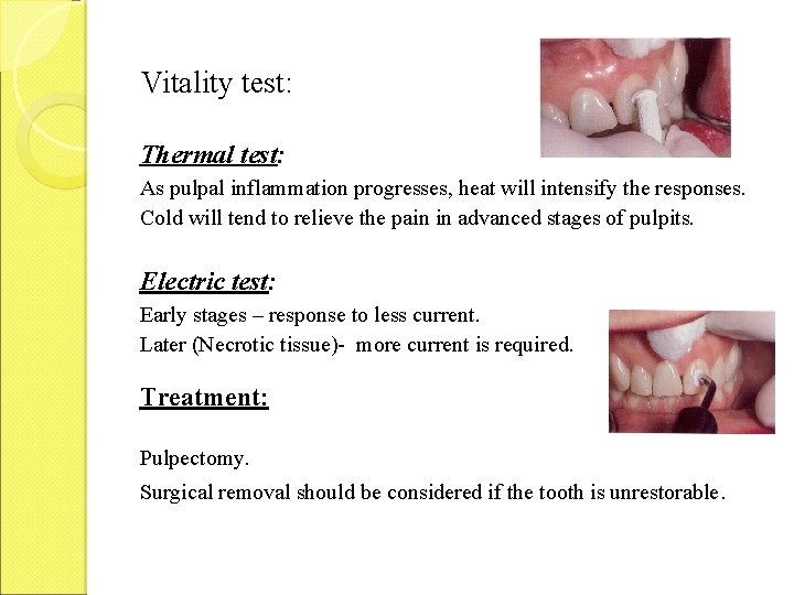 Vitality test: Thermal test: As pulpal inflammation progresses, heat will intensify the responses. Cold Vitality test: Thermal test: As pulpal inflammation progresses, heat will intensify the responses. Cold
