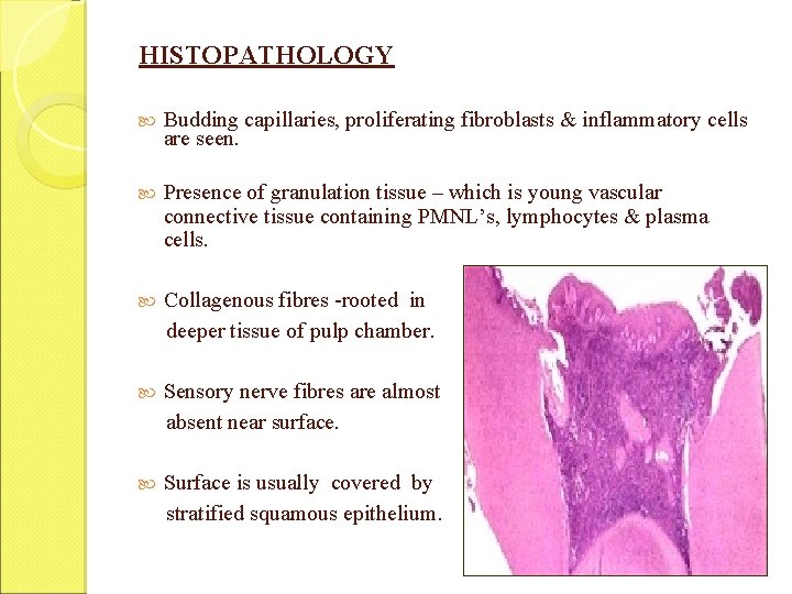 HISTOPATHOLOGY Budding capillaries, proliferating fibroblasts & inflammatory cells are seen. Presence of granulation tissue HISTOPATHOLOGY Budding capillaries, proliferating fibroblasts & inflammatory cells are seen. Presence of granulation tissue