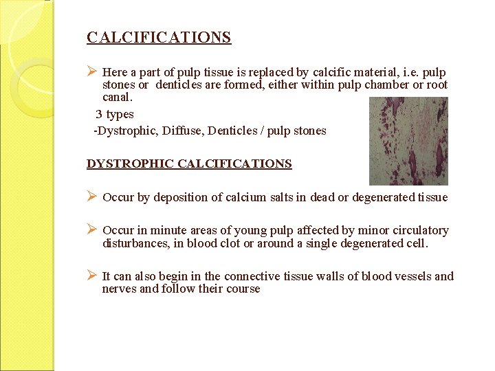 CALCIFICATIONS Ø Here a part of pulp tissue is replaced by calcific material, i.