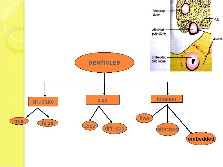 DENTICLES true false location size structure free Local diffused attached embedded 