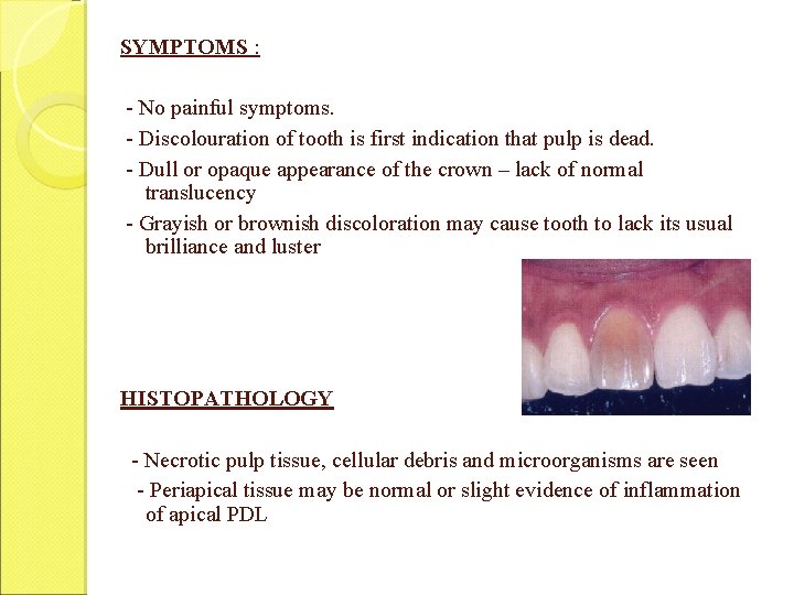 SYMPTOMS : - No painful symptoms. - Discolouration of tooth is first indication that