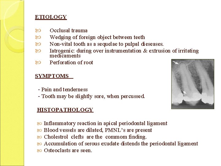 ETIOLOGY Occlusal trauma Wedging of foreign object between teeth Non-vital tooth as a sequelae