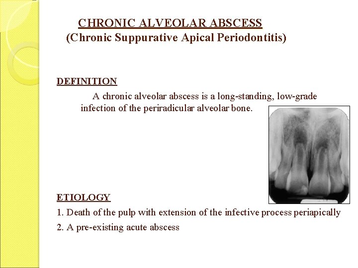 CHRONIC ALVEOLAR ABSCESS (Chronic Suppurative Apical Periodontitis) DEFINITION A chronic alveolar abscess is a