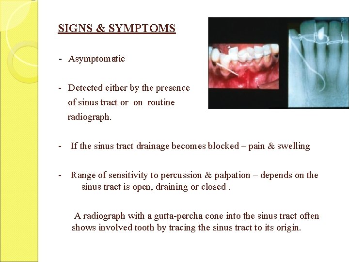 SIGNS & SYMPTOMS - Asymptomatic - Detected either by the presence of sinus tract