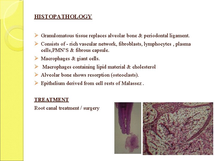 HISTOPATHOLOGY Ø Granulomatous tissue replaces alveolar bone & periodontal ligament. Ø Consists of -