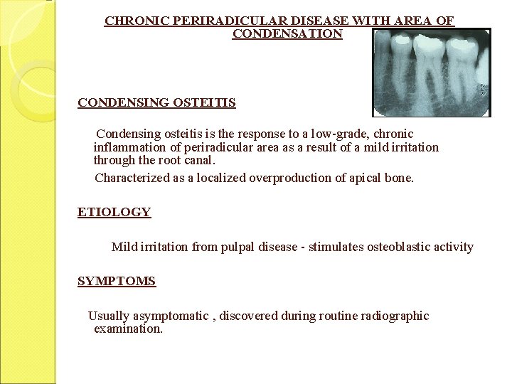 CHRONIC PERIRADICULAR DISEASE WITH AREA OF CONDENSATION CONDENSING OSTEITIS Condensing osteitis is the response CHRONIC PERIRADICULAR DISEASE WITH AREA OF CONDENSATION CONDENSING OSTEITIS Condensing osteitis is the response