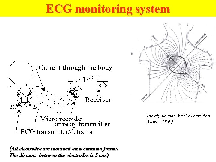 ECG monitoring system The dipole map for the heart from Waller (1889) (All electrodes