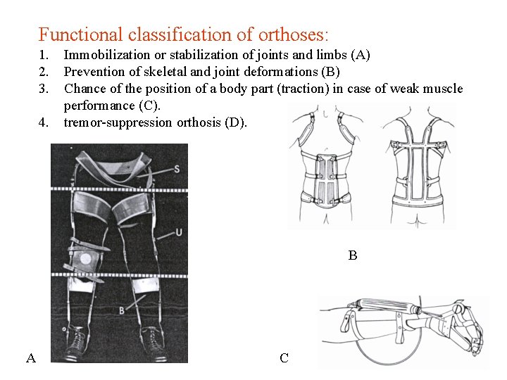 Functional classification of orthoses: 1. 2. 3. 4. Immobilization or stabilization of joints and