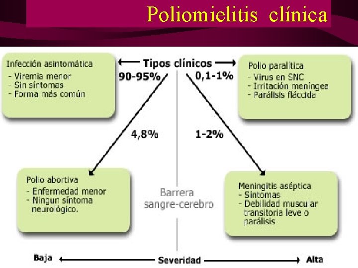 Poliomielitis clínica Poliomielitis clínica