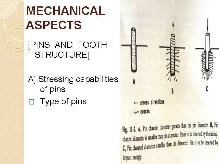 MECHANICAL ASPECTS [PINS AND TOOTH STRUCTURE] A] Stressing capabilities of pins � Type of