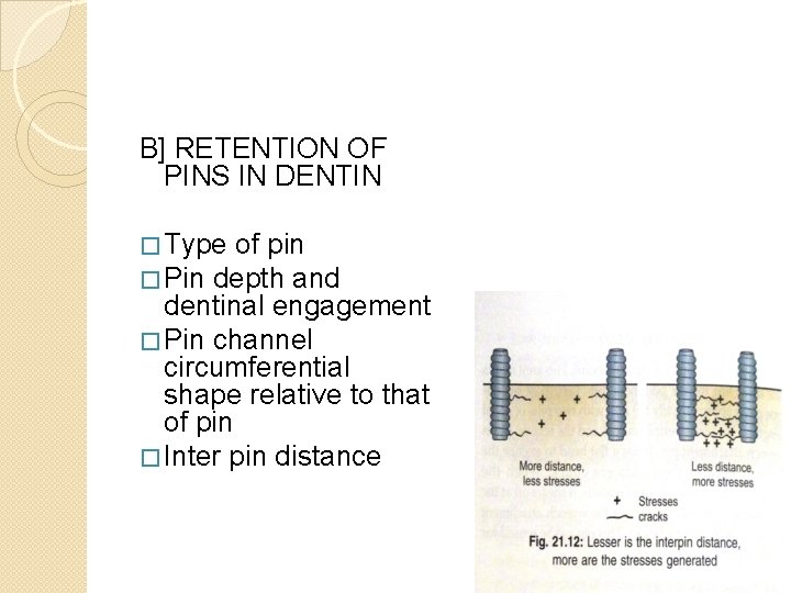 B] RETENTION OF PINS IN DENTIN � Type of pin � Pin depth and