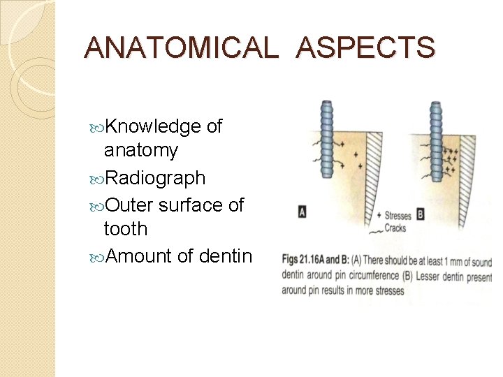 ANATOMICAL ASPECTS Knowledge of anatomy Radiograph Outer surface of tooth Amount of dentin 