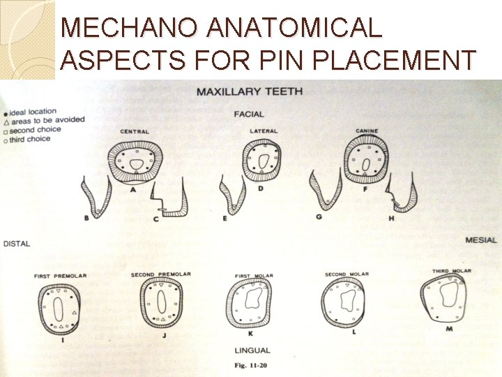 MECHANO ANATOMICAL ASPECTS FOR PIN PLACEMENT 