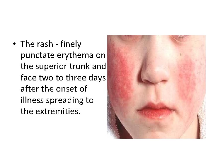  • The rash - finely punctate erythema on the superior trunk and face