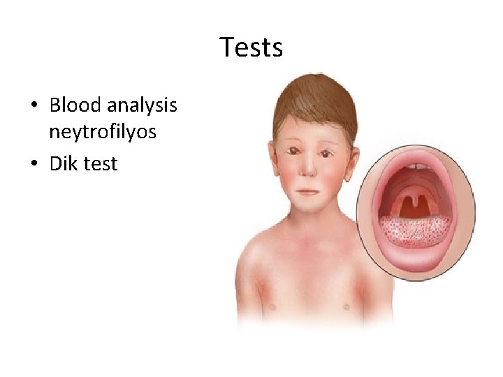 Tests • Blood analysis neytrofilyos • Dik test 
