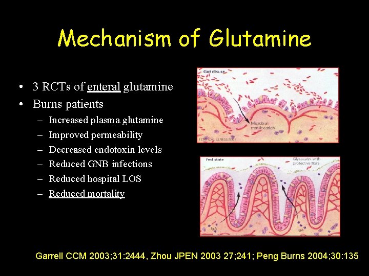 Mechanism of Glutamine • 3 RCTs of enteral glutamine • Burns patients – –