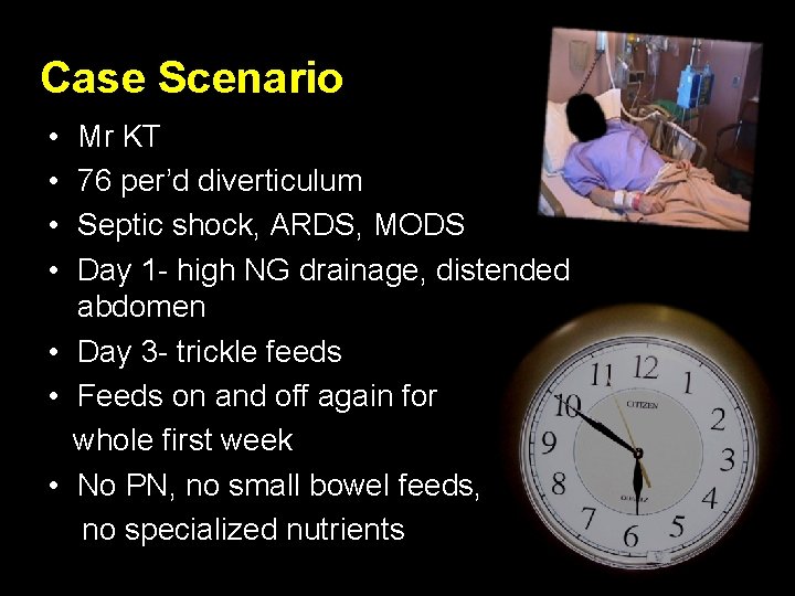 Case Scenario • • Mr KT 76 per’d diverticulum Septic shock, ARDS, MODS Day