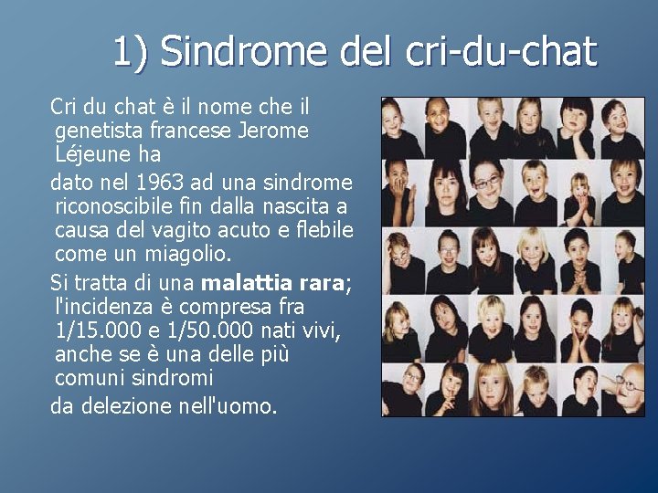 1) Sindrome del cri-du-chat Cri du chat è il nome che il genetista francese 1) Sindrome del cri-du-chat Cri du chat è il nome che il genetista francese