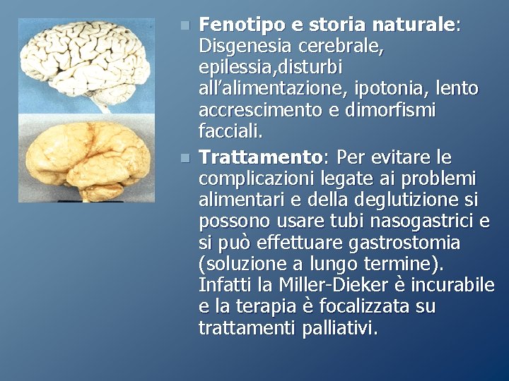 n n Fenotipo e storia naturale: Disgenesia cerebrale, epilessia, disturbi all’alimentazione, ipotonia, lento accrescimento n n Fenotipo e storia naturale: Disgenesia cerebrale, epilessia, disturbi all’alimentazione, ipotonia, lento accrescimento