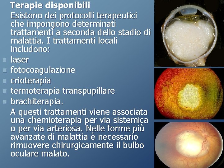 Terapie disponibili Esistono dei protocolli terapeutici che impongono determinati trattamenti a seconda dello stadio Terapie disponibili Esistono dei protocolli terapeutici che impongono determinati trattamenti a seconda dello stadio