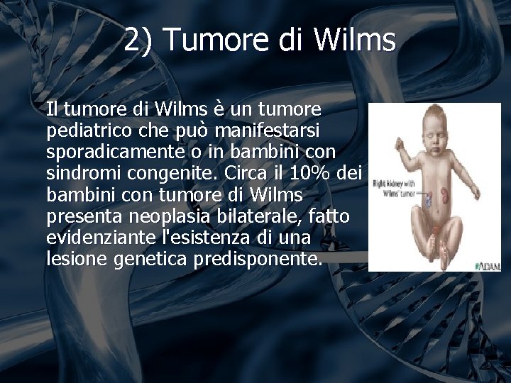 2) Tumore di Wilms Il tumore di Wilms è un tumore pediatrico che può 2) Tumore di Wilms Il tumore di Wilms è un tumore pediatrico che può