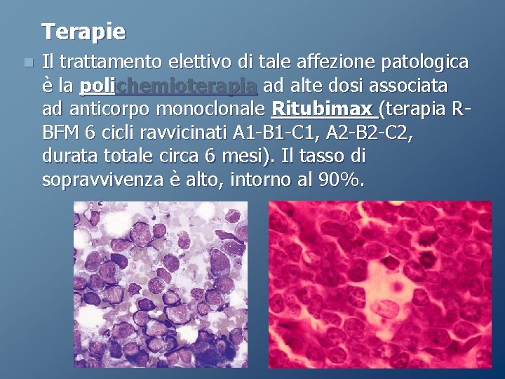 Terapie n Il trattamento elettivo di tale affezione patologica è la polichemioterapia ad alte Terapie n Il trattamento elettivo di tale affezione patologica è la polichemioterapia ad alte