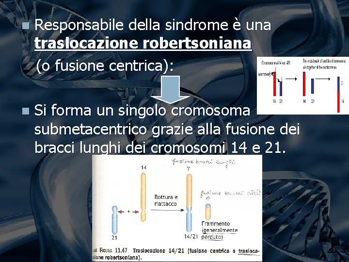 n Responsabile della sindrome è una traslocazione robertsoniana (o fusione centrica): n Si forma n Responsabile della sindrome è una traslocazione robertsoniana (o fusione centrica): n Si forma