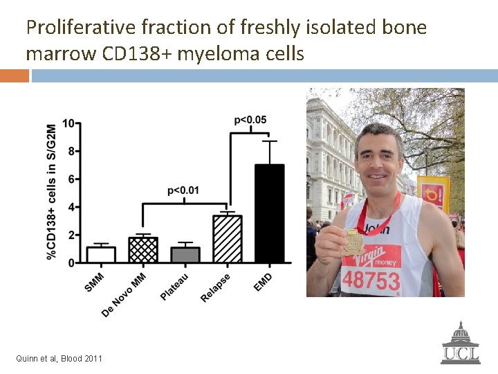 Proliferative fraction of freshly isolated bone marrow CD 138+ myeloma cells Smouldering MM =