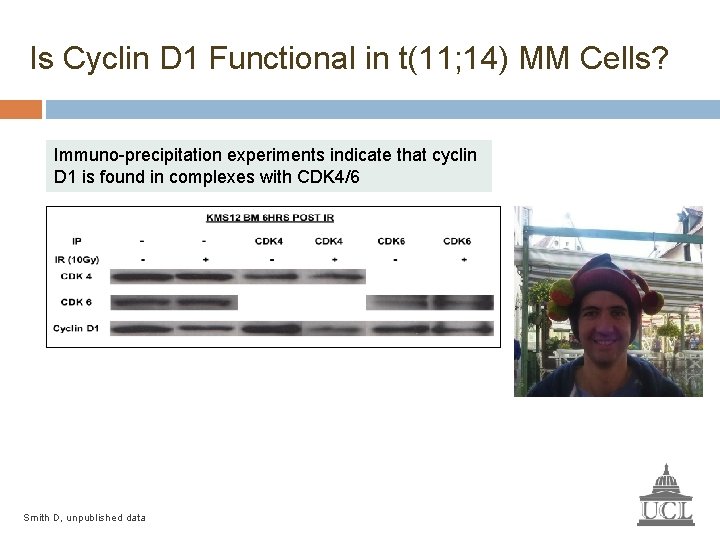 Is Cyclin D 1 Functional in t(11; 14) MM Cells? Immuno-precipitation experiments indicate that
