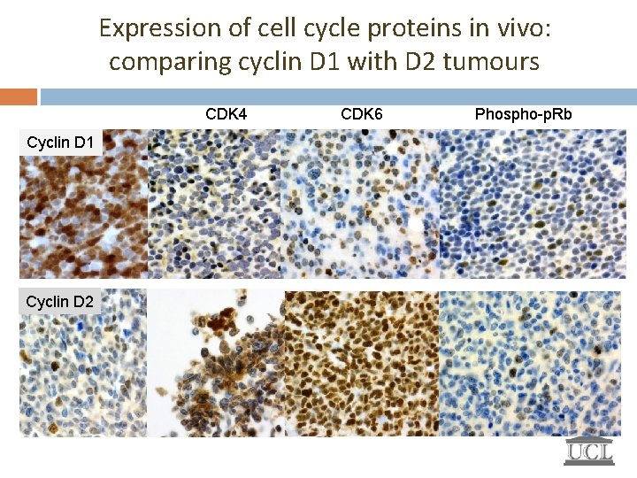 Expression of cell cycle proteins in vivo: comparing cyclin D 1 with D 2