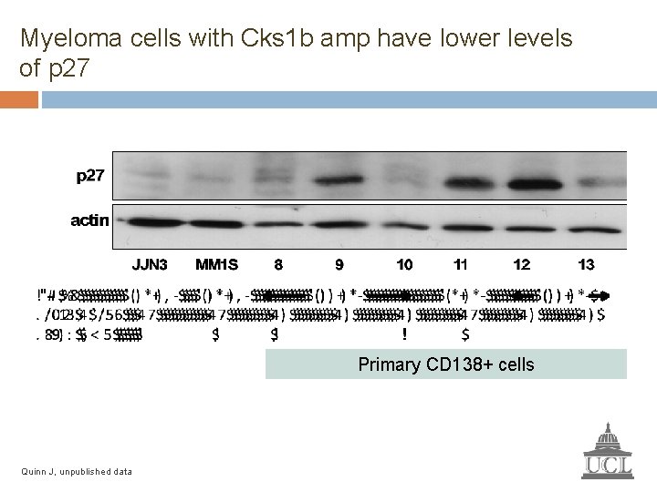 Myeloma cells with Cks 1 b amp have lower levels of p 27 Primary