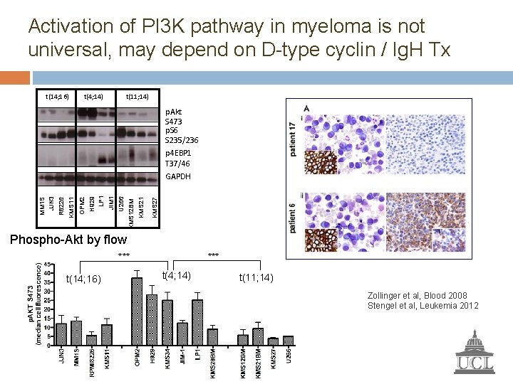 Activation of PI 3 K pathway in myeloma is not universal, may depend on