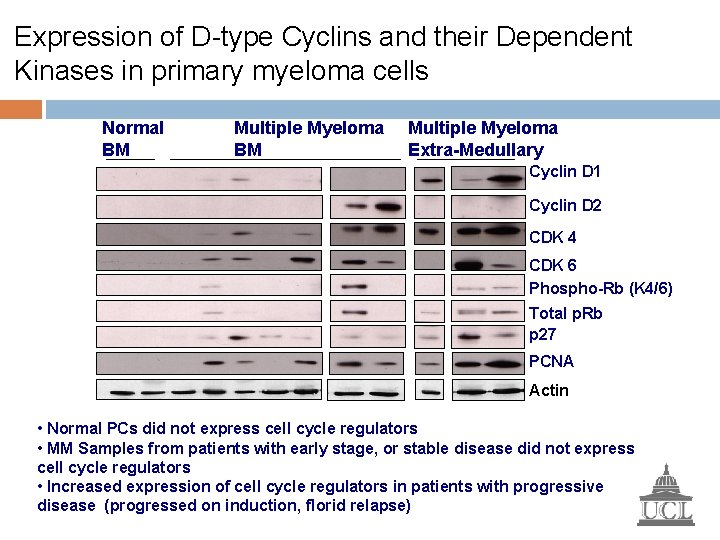 Expression of D-type Cyclins and their Dependent Kinases in primary myeloma cells Normal BM