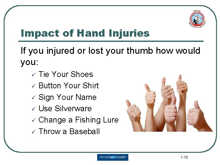 Impact of Hand Injuries If you injured or lost your thumb how would you: