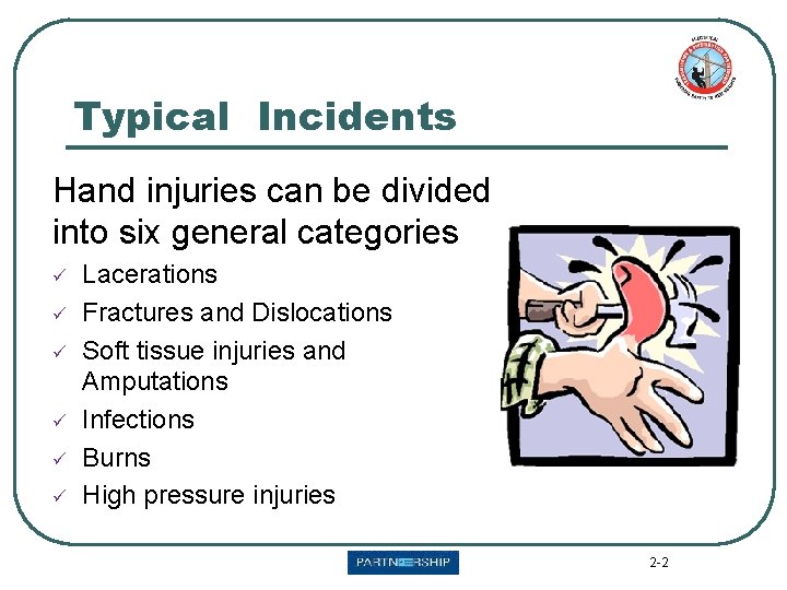 Typical Incidents Hand injuries can be divided into six general categories ü ü ü