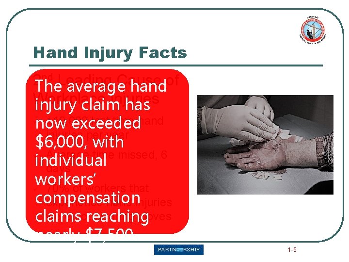 Hand Injury Facts nd Leading Cause of 2 The average hand Workplace injuries injury