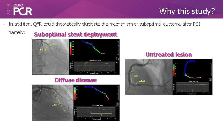 Why this study? • In addition, QFR could theoretically elucidate the mechanism of suboptimal