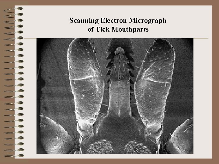 Scanning Electron Micrograph of Tick Mouthparts Scanning Electron Micrograph of Tick Mouthparts