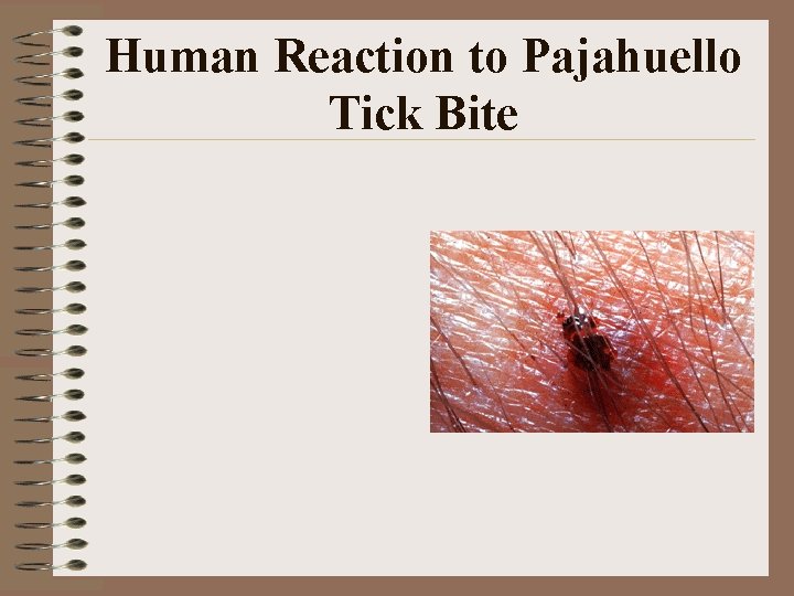 Human Reaction to Pajahuello Tick Bite Human Reaction to Pajahuello Tick Bite